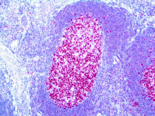 IHC of Bcl-6 on an FFPE Tonsil Tissue